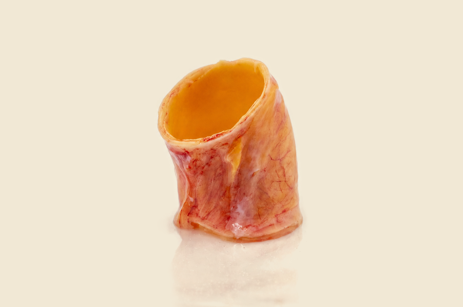 Section of human aorta on a cream background